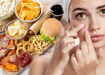 Ảnh hưởng của chế độ ăn với bệnh trứng cá