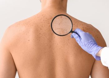 Cách phòng ngừa ung thư da