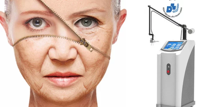 Trẻ hóa da bằng Laser